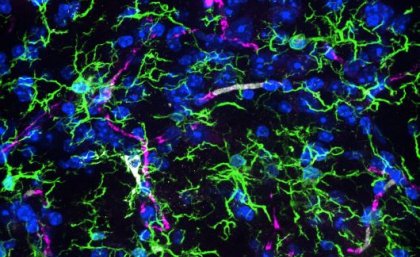 A microscope snapshot of microglia (green cells) in an ageing mouse brain, extending their cellular processes to monitor and support the nerve cell function. A microscope snapshot of brightly coloured flecks of blue, green and pink against a black background.